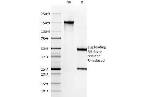 SDS-PAGE Analysis Purified SM-MHC Monoclonal Antibody (SMMS-1). (MYH11 antibody)