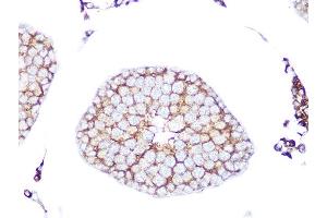 Immunohistochemistry of paraffin-embedded rat testis using RA Rabbit mAb (ABIN7269817) at dilution of 1:100 (40x lens). (RAB9A antibody)