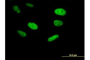 Immunofluorescence of purified MaxPab antibody to ING5 on HeLa cell. (ING5 antibody  (AA 1-240))