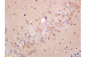 Formalin-fixed and paraffin embedded rat brain labeled with Anti-MRGX1/MRGPRC/SNSR Polyclonal Antibody, Unconjugated (ABIN718751) at 1:200 followed by conjugation to the secondary antibody and DAB staining. (MRGPRX1/3/4 (AA 21-120) antibody)
