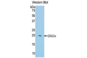 Western Blotting (WB) image for anti-Keratin 2 (KRT2) (AA 368-507) antibody (ABIN1859578) (Keratin 2 antibody  (AA 368-507))