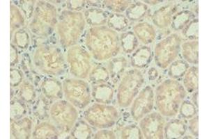 Immunohistochemistry of paraffin-embedded human kidney tissue using ABIN7142338 at dilution of 1:100 (PDPK1 antibody  (AA 277-556))