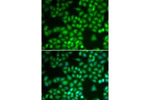 Immunofluorescence analysis of A549 cells using NFKB1 antibody (ABIN5974018). (NFKB1 antibody)