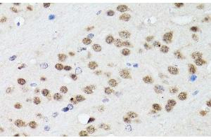 Immunohistochemistry of paraffin-embedded Mouse brain using TIA1 Polyclonal Antibody at dilution of 1:100 (40x lens). (TIA1 antibody)