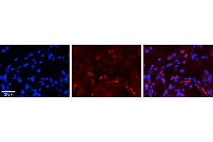 Rabbit Anti-GAA Antibody     Formalin Fixed Paraffin Embedded Tissue: Human Lung Tissue  Observed Staining: Cytoplasmic in alveolar type I cells  Primary Antibody Concentration: 1:100  Other Working Concentrations: 1/600  Secondary Antibody: Donkey anti-Rabbit-Cy3  Secondary Antibody Concentration: 1:200  Magnification: 20X  Exposure Time: 0. (GAA antibody  (N-Term))