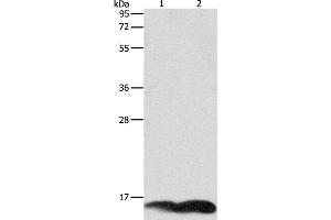 Western Blot analysis of A549 and Jurkat cell using PFN1 Polyclonal Antibody at dilution of 1:1000 (PFN1 antibody)