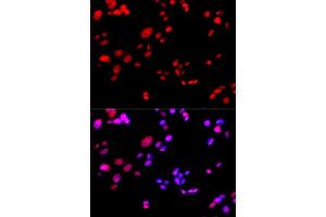 Immunofluorescence analysis of GFP-RNF168 transgenic U2OS cells using RPA2 antibody. (RPA2 antibody  (AA 80-270))