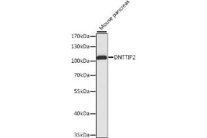 Western blot analysis of extracts of mouse pancreas, using DNTTIP2 antibody (ABIN7266732) at 1:1000 dilution. (DNTTIP2 antibody  (AA 1-300))