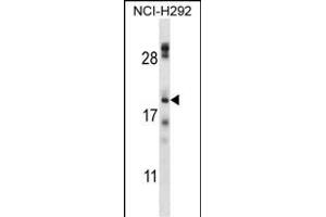 TMEM17 Antibody (N-term) (ABIN657609 and ABIN2846606) western blot analysis in NCI- cell line lysates (35 μg/lane).
