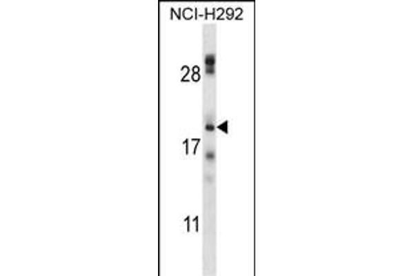 TMEM17 Antikörper  (N-Term)