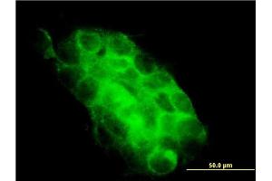 Immunofluorescence of monoclonal antibody to USP31 on A-431 cell. (USP31 antibody  (AA 1254-1352))