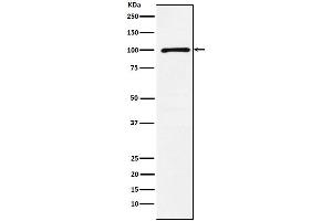 Western blot analysis of GRIK2 expression in A431 cell lysate.