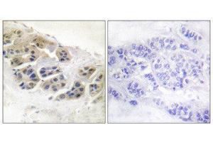 Immunohistochemistry (IHC) image for anti-Mammaglobin (Internal Region) antibody (ABIN1848654)