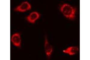 ABIN6275885 staining 293 cells by IF/ICC. (Desmoglein 1 antibody  (N-Term))