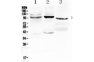 Western blot analysis of ATF6 using anti- ATF6 antibody .