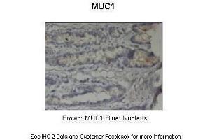 Sample Type :  Pig stomach  Primary Antibody Dilution :  1:500  Secondary Antibody :  Anti-rabbit-HRP  Secondary Antibody Dilution :  1:1000  Color/Signal Descriptions :  Brown: MUC1 Blue: Nucleus  Gene Name :  MUC1  Submitted by :  Dr. (MUC1 antibody  (C-Term))