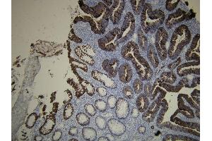Immunohistochemistry (IHC) image for anti-Keratin 20 (KRT20) (AA 408-424), (C-Term) antibody (ABIN870620) (KRT20 antibody  (C-Term))