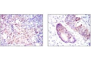 Immunohistochemistry (IHC) image for anti-Argininosuccinate Synthase 1 (ASS1) antibody (ABIN1105455) (ASS1 antibody)