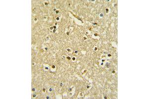 Formalin-fixed and paraffin-embedded human brain tissue with PAX6 Antibody , which was peroxidase-conjugated to the secondary antibody, followed by DAB staining. (PAX6 antibody  (AA 183-210))