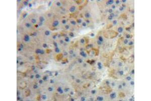 Used in DAB staining on fromalin fixed paraffin-embedded liver tissue (ANG antibody  (AA 25-147))