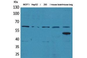 Western Blotting (WB) image for anti-Zinc Finger Protein 307 (ZKSCAN4) (Internal Region) antibody (ABIN3187831) (ZKSCAN4 antibody  (Internal Region))