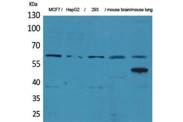 ZKSCAN4 antibody  (Internal Region)