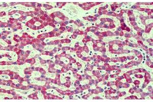 Human Liver: Formalin-Fixed, Paraffin-Embedded (FFPE) (RAGE antibody  (Cy3))