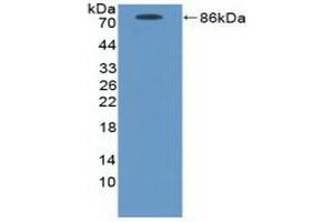 Detection of Recombinant ICAM1, Canine using Polyclonal Antibody to Intercellular Adhesion Molecule 1 (ICAM1) (ICAM1 antibody  (AA 25-531))