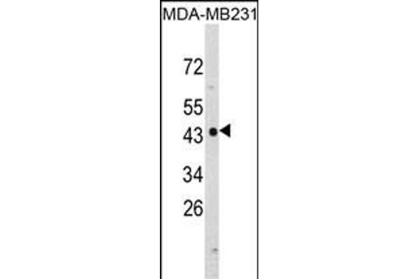 NDRG1 anticorps  (N-Term)