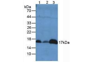 Western blot analysis of (1) Mouse Liver Tissue, (2) Mouse Lung Tissue and (3) Mouse Kidney Tissue.