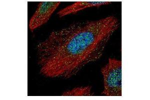 ICC/IF Image Confocal immunofluorescence analysis (Olympus FV10i) of paraformaldehyde-fixed HeLa, using TAB1, antibody (Green) at 1:500 dilution. (TAB1 antibody)