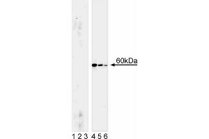 Western blot analysis for Akt (pS472/pS473). (AKT1 antibody  (pSer472))