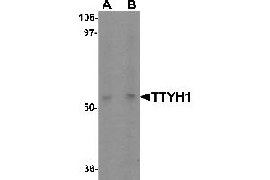 Western blot analysis of TTYH1 in Raji cell lysate with TTYH1 antibody at (A) 1 and (B) 2 µg/mL.