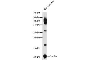 Western blot analysis of extracts of Rat pancreas, using Insulin antibody (ABIN3022884, ABIN3022885, ABIN3022886 and ABIN6219279) at 1:1000 dilution. (Insulin antibody  (AA 1-110))