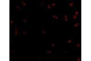 Immunofluorescence of Integrin alpha 4 in Jurkat cells with AP30436PU-N Integrin alpha 4 antibody at 2 μg/ml. (ITGA4 antibody  (Center))