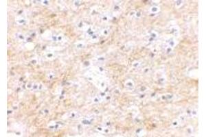 Immunohistochemical staining of human brain tissue using DLGAP3 polyclonal antibody  at 2. (DLGAP3 antibody  (C-Term))