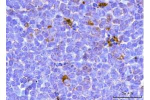 IHC analysis of TFEB using anti-TFEB antibody (ABIN7600648). (TFEB antibody  (AA 214-326))