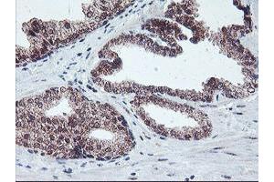 Image no. 1 for anti-Protein Phosphatase 1, Regulatory (Inhibitor) Subunit 15A (PPP1R15A) antibody (ABIN1498364) (GADD34 antibody)