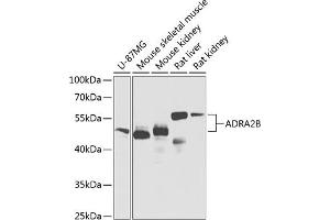 Western blot analysis of extracts of various cell lines, using B Antibody (ABIN6134019, ABIN6136597, ABIN6136598 and ABIN6224629) at 1:1000 dilution. (ADRA2B antibody  (AA 1-100))