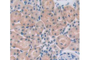 Used in DAB staining on fromalin fixed paraffin-embedded testis tissue (HSPA2 antibody  (AA 1-633))