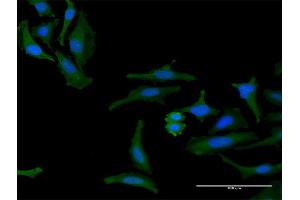Immunofluorescence of purified MaxPab antibody to FAM60A on HeLa cell. (FAM60A antibody  (AA 1-221))