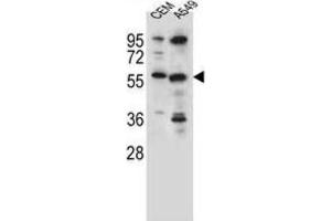 Western Blotting (WB) image for anti-Cysteine Sulfinic Acid Decarboxylase (CSAD) antibody (ABIN2996373)
