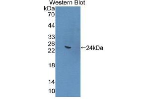 Western blot analysis of the recombinant protein. (ANGPTL4 antibody  (AA 228-389))