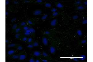 Immunofluorescence of monoclonal antibody to APOC3 on HeLa cell. (APOC3 antibody  (AA 21-99))