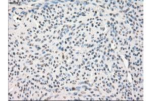 Immunohistochemical staining of paraffin-embedded pancreas tissue using anti-LTA4Hmouse monoclonal antibody. (LTA4H antibody)