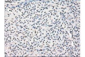 Immunohistochemical staining of paraffin-embedded pancreas tissue using anti-LTA4Hmouse monoclonal antibody. (LTA4H antibody)