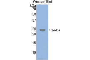Western Blotting (WB) image for anti-Glutathione Synthetase (GSS) (AA 270-474) antibody (ABIN1859086) (Glutathione Synthetase antibody  (AA 270-474))