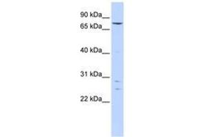 Image no. 1 for anti-Kelch-Like 4 (KLHL4) (AA 35-84) antibody (ABIN6740599) (Kelch-Like 4 antibody  (AA 35-84))