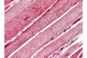 Human Skeletal Muscle (formalin-fixed, paraffin-embedded) stained with BAK1at 10 µg/ml followed by biotinylated goat anti-rabbit IgG secondary antibody, alkaline phosphatase-streptavidin and chromogen. (BAK1 antibody  (N-Term))
