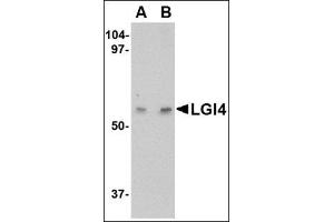 Western blot analysis of LGI4 in human brain tissue lysate with this product at (A) 1 and (B) 2 μg/ml.